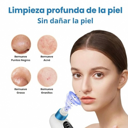 Krezia™ Quita Puntos Negros con Tecnología de Succión Avanzada.