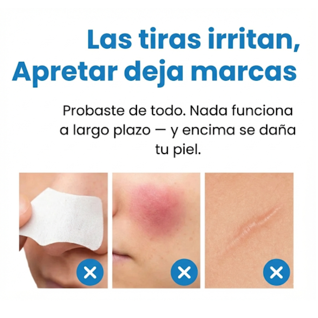 Krezia™ Quita Puntos Negros con Tecnología de Succión Avanzada.