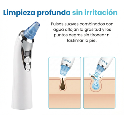 Krezia™ Quita Puntos Negros con Tecnología de Succión Avanzada.